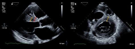 mdmath echocardiography.